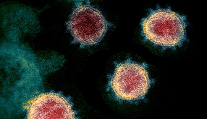 Tecnologia que sequenciou coronavírus em 48 horas permitirá monitorar epidemia em tempo real